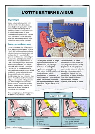 L’OTITE EXTERNE AIGUË
  Étymologie
  L'otite est une inﬂammation ou/et
  infection de l'oreille. Le mot otite
  vient du grec oto qui signiﬁe oreille
  avec le sufﬁxe *ite désignant, en
  médecine, une maladie inﬂammatoi-
  re. L'oreille est divisée en trois
  parties anatomiques et donc il existe
  trois localisation d'otite : les otites
  externes, les otites moyennes et les
  otites internes (ou labyrinthites).

  Processus pathologique
  L'otite externe est une inﬂammation
  de la peau du conduit auditif externe
  (CAE). Elle est la conséquence d'une
  infection de ce conduit, infection qui
  peut parfois être purulente. Le
  tympan n'est donc pas concerné par
                                                                                          image extraite de http://www.conseils-orl.com/
  le processus qui siège uniquement au
  niveau de la peau de revêtement du          Loin des grands accidents de plongée        Sa cause primaire n'est pas les
  CAE. C'est une pathologie rencontrée        impressionnants appris dans nos             bactéries de l'eau dans laquelle vous
  essentiellement en été, car elle est        différents cours, une pathologie            avez plongé mais un conduit auditif
  favorisée par la chaleur, l'humidité,       douloureuse de l’oreille gâche              fragilisé et/ou de l'eau qui persiste
  l'eau de mer, et frappe essentielle-        régulièrement la vie du plongeur :          dans le conduit externe. La prévention
  ment les jeunes enfants qui ont le CAE
                                              l’otite externe aiguë. Elle est tellement   passe par éviter de traumatiser le
  plus étroit. L’otite externe des plon-
                                              caractéristique des activités               conduit (avec des coton-tiges par
  geurs ne diffère de celle des non-
  plongeurs que par une fréquence plus
                                              aquatiques que les anglo-saxons la          exemple), par un rinçage des oreilles à
  élevée et des facteurs favorisants spé-     nomme « swimmer’s ear », l’oreille du       l'eau douce et, pour les plongeurs
  ciﬁques aux activités subaquatiques.        nageur. Son apparition est soudaine,        souffrant d'otites externes à
  Ces otites sont plus fréquentes et          elle empire rapidement pour devenir         répétition, par le séchage du conduit.
  graves chez les diabétiques. L’otite        douloureuse. Elle peut être uni ou bi-
  externe est également associée aux          latérale.
  maladies de la peau, comme la
  dermatose et le psoriasis.

  Pour nous plongeurs, il est important
  de différencier cette otite externe
                                                                        Anatomie




  OREILLE EXTERNE                           OREILLE MOYENNE                                  OREILLE INTERNE
   - CAE : conduit auditif externe           - Ma : marteau                                    - CSC : canaux semi-circulaires
   - T : tympan                              - En : Enclume                                    - FO/FR : foramen ovale/rond
                                             - Et : Étrier                                     - RV/RT : Cochlée (rampe vestibulaire/
                                             - TE : trompe d’Eustache                        tympanique)
Mark 5 - RCAE Plongée
                                        
                                                                            xx
 