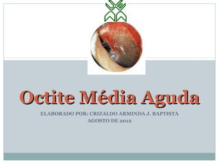 Octite Média Aguda
  ELABORADO POR: CRIZALDO ARMINDA J. BAPTISTA
                AGOSTO DE 2012
 