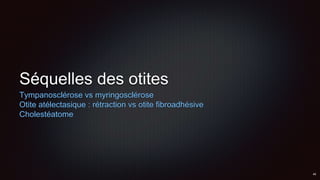 Séquelles des otites
Tympanosclérose vs myringosclérose
Otite atélectasique : rétraction vs otite fibroadhésive
Cholestéatome
 