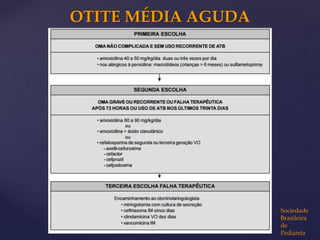 OTITE MÉDIA AGUDA
Sociedade
Brasileira
de
Pediatria
 
