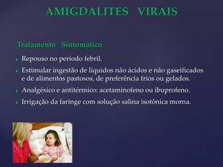 AMIGDALITES VIRAIS
Tratamento Sintomático
 Repouso no período febril.
 Estimular ingestão de líquidos não ácidos e não gaseificados
e de alimentos pastosos, de preferência frios ou gelados.
 Analgésico e antitérmico: acetaminofeno ou ibuprofeno.
 Irrigação da faringe com solução salina isotônica morna.
 