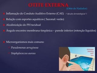 OTITE EXTERNA
 Inflamação do Conduto Auditivo Externo (CAE) (“afecções dermatológicas”)
 Relação com esportes aquáticos ( Sazonal: verão)
 Alcalinizãção do PH tecidual
 Ângulo encontro membrana timpânica – parede inferior (retenção líquidos)
 Microorganismos mais comuns:
 Pseudomonas aeruginosa
 Staphylococcus aureus
(Otite do Nadador)
 