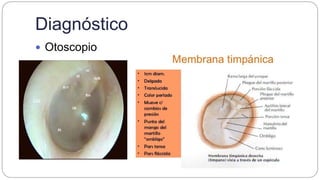 Diagnóstico
 Otoscopio
 