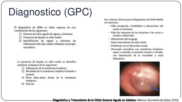 Otitis