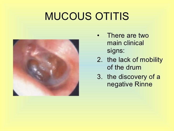 Otitis part 3
