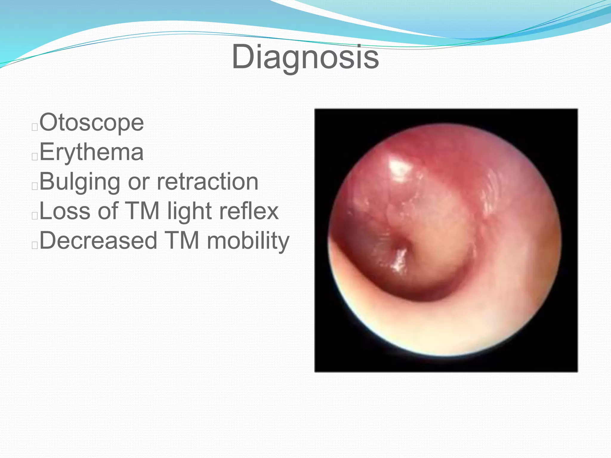 Otitis Media PPTX Ear Nose And Throat Conditions Diseases And otitis-media-pptx-ear-nose-and-throat-conditions-diseases-and
