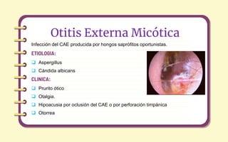 Infección del CAE producida por hongos saprófitos oportunistas.
ETIOLOGIA:
 Aspergillus
 Cándida albicans
CLINICA:
 Prurito ótico
 Otalgia.
 Hipoacusia por oclusión del CAE o por perforación timpánica
 Otorrea
Otitis Externa Micótica
 