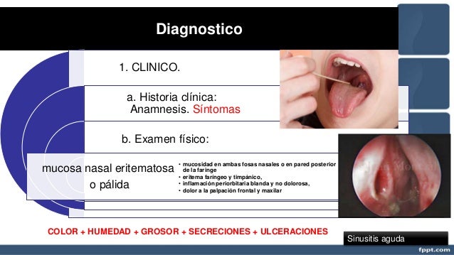 Otitis Sinusitis Rinitis Faringitis Otitis Sinusitis Rinitis Faringitis