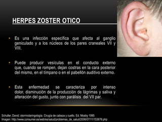 Herpes zoster otico                                    .Es una infección específica que afecta al ganglio geniculado y a los núcleos de los pares craneales VII y VIII. Puede producir vesículas en el conducto externo que, cuando se rompen, dejan costras en la cara posterior del mismo, en el tímpano o en el pabellón auditivo externo.Esta enfermedad se caracteriza por intenso dolor, disminución de la producción de lágrimas y saliva y alteración del gusto, junto con parálisis  del VII par. Schuller, David; otorrinolaringología. Cirugía de cabeza y cuello. Ed. Mosby 1995Imagen: http://www.consumer.es/web/es/salud/problemas_de_salud/2006/07/11/153676.php