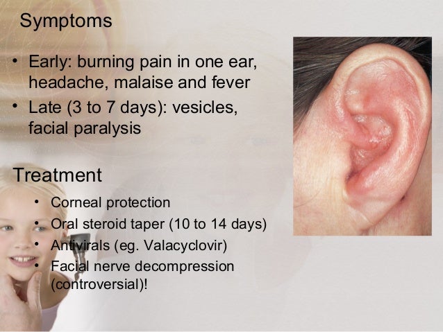 Otitis Externa Otitis Externa