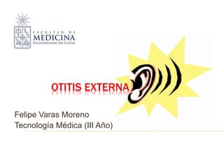 OTITIS EXTERNA
Felipe Varas Moreno
Tecnología Médica (III Año)
 