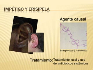 IMPÉTIGO Y ERISIPELA
Agente causal
Tratamiento:
Estreptococo β -hemolitico
Tratamiento local y uso
de antibióticos sistémicos
 