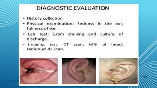 Presentation title
16
 