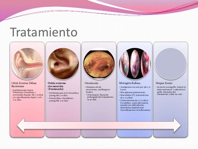 El complot del hongo en las uñas