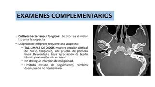 • Cultivos bacteriano y fúngicos: de otorrea al iniciar
tto ante la sospecha
• Diagnóstico temprano requiere alta sospecha:
• TAC SIMPLE DE OIDOS muestra erosión cortical
de hueso timpánico, útil prueba de primera
línea. Desventajas, baja apreciación de tejido
blando y extensión intracraneal.
• No distingue infección de malignidad.
• Limitado estudio de seguimiento, cambios
óseos puede no normalizarse.
EXAMENES COMPLEMENTARIOS
 