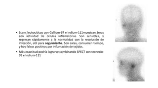 • Scans leukociticos con Gallium-67 e Indium-111muestran áreas
con actividad de células inflamatorias. Son sensibles, y
regresan rápidamente a la normalidad con la resolución de
infección, útil para seguimiento. Son caras, consumen tiempo,
y hay falsos positivos por inflamación de tejidos.
• Más exactitud podría lograrse combinando SPECT con tecnecio-
99 e Indium-111
 