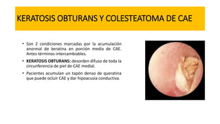 KERATOSIS OBTURANS Y COLESTEATOMA DE CAE
• Son 2 condiciones marcadas por la acumulación
anormal de keratina en porción media de CAE.
Antes términos intercambiables.
• KERATOSIS OBTURANS: desorden difuso de toda la
circunferencia de piel de CAE medial.
• Pacientes acumulan un tapón denso de queratina
que puede ocluir CAE y dar hipoacusia conductiva.
 