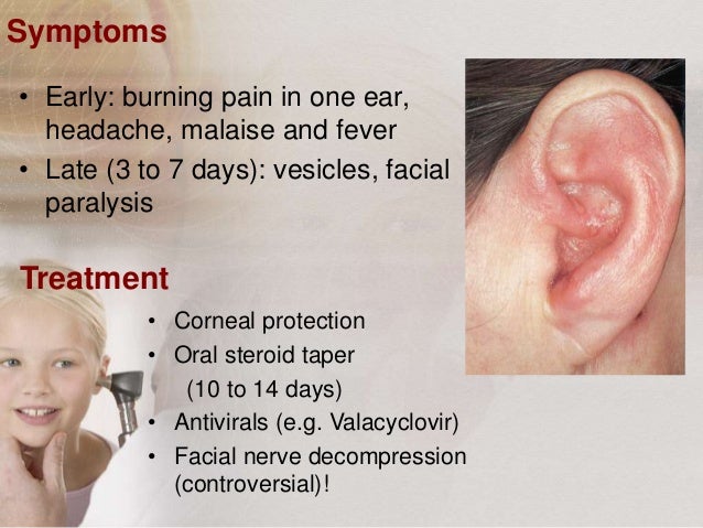 Chapter 16 Review Otolaryngology Flashcards