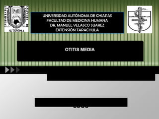 LOGO
UNIVERSIDAD AUTÓNOMA DE CHIAPAS
FACULTAD DE MEDICINA HUMANA
DR. MANUEL VELASCO SUAREZ
EXTENSIÓN TAPACHULA
OTITIS MEDIA
 