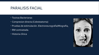 PARALISIS FACIAL
 Toxinas Bacterianas
 Compresion directa (Colesteatoma)
 Pruebas de estimulación. Electroneurografia/Miografia,
 RM contrastada.
 Historia clínica

 