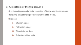3) Atelectasis of the tympanum :
 It is the collapse and medial retraction of the tympanic membrane
following long standing non-supurrative otitis media.
 Stages :
i. Effusion stage
ii. Retraction stage
iii. Atelectatic eardrum
iv. Adhesive otitis media
 