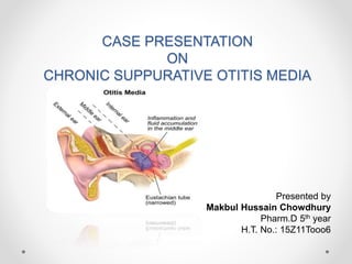 CASE PRESENTATION
ON
CHRONIC SUPPURATIVE OTITIS MEDIA
Presented by
Makbul Hussain Chowdhury
Pharm.D 5th year
H.T. No.: 15Z11Tooo6
 