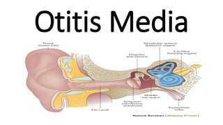 Otitis Media
 