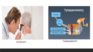 OTOSCOPY TYMPANOMETRY
 