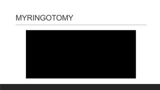 MYRINGOTOMY
 