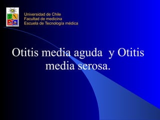 Universidad de Chile Facultad de medicina Escuela de Tecnología médica Otitis media aguda  y Otitis media serosa. 