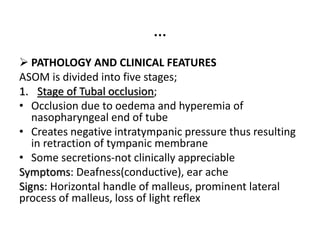 …
 PATHOLOGY AND CLINICAL FEATURES
ASOM is divided into five stages;
1. Stage of Tubal occlusion;
• Occlusion due to oedema and hyperemia of
nasopharyngeal end of tube
• Creates negative intratympanic pressure thus resulting
in retraction of tympanic membrane
• Some secretions-not clinically appreciable
Symptoms: Deafness(conductive), ear ache
Signs: Horizontal handle of malleus, prominent lateral
process of malleus, loss of light reflex
 