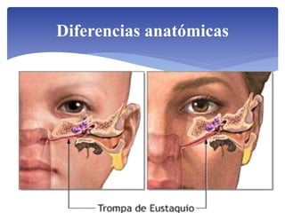 Diferencias anatómicas
 