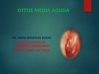DR. OMAR GONZALES SUAZO.
JEFE DE SERVICIO DE
OTORRINOLARINGOLOGIA.
CLINICA PADRE LUIS TEZZA.
OTITIS MEDIA AGUDA
 