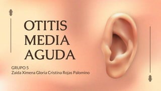 OTITIS
MEDIA
AGUDA
GRUPO 5
Zaida Ximena Gloria Cristina Rojas Palomino
 
