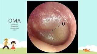 OMA
posición
movilidad
translucidez,
color
 