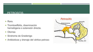 PETROSITIS
 Rara.
 Tromboeflbitis, diseminación

hematógena o extensión directa.
 Otorrea
 Sindrome de Gradenigo
 Antibioticos y drenaje del vértice petroso

 