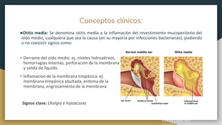 Conceptos clínicos:
●Otitis media: Se denomina otitis medía a la inflamación del revestimiento mucoperióstio del
oído medio, cualquiera que sea la causa (en su mayoría por infecciones bacterianas), pudiendo
o no coexistir signos como:
(Lieberthal AS,
• Derrame del oído medio: ej. niveles hidroaéreos,
hemorragias internas, perforación de la membrana
y salida de liquido.
• Inflamación de la membrana timpánica: ej.
membrana timpánica abultada, eritema de la
membrana, engrosamiento de la membrana.
Signos clave: Otalgia e hipoacusia
 