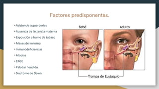 Factores predisponentes.
• Asistencia a guarderías
• Ausencia de lactancia materna
• Exposición a humo de tabaco
• Meses de invierno
• Inmunodeficiencias
• Atopias
• ERGE
• Paladar hendido
• Síndrome de Down
 