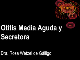 Otitis Media Aguda y
Secretora
Dra. Rosa Wetzel de Gálligo
 