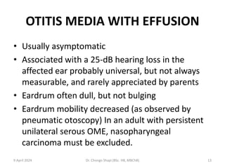OTITIS MEDIA WITH EFFUSION
• Usually asymptomatic
• Associated with a 25-dB hearing loss in the
affected ear probably universal, but not always
measurable, and rarely appreciated by parents
• Eardrum often dull, but not bulging
• Eardrum mobility decreased (as observed by
pneumatic otoscopy) In an adult with persistent
unilateral serous OME, nasopharyngeal
carcinoma must be excluded.
9 April 2024 Dr. Chongo Shapi (BSc. HB, MBChB) 13
 