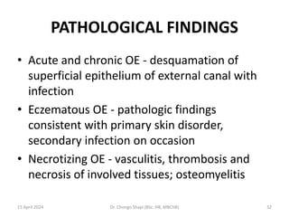 PATHOLOGICAL FINDINGS
• Acute and chronic OE - desquamation of
superficial epithelium of external canal with
infection
• Eczematous OE - pathologic findings
consistent with primary skin disorder,
secondary infection on occasion
• Necrotizing OE - vasculitis, thrombosis and
necrosis of involved tissues; osteomyelitis
15 April 2024 Dr. Chongo Shapi (BSc. HB, MBChB) 32
 