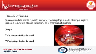 .
Educación y remisión
Se recomienda la pronta remisión a un otorrinolaringólogo cuando otoscopia sugiere
posible o inminente, el daño estructural de la membrana timpánica.
Cirugía
 Pacientes <4 años de edad
 Pacientes >4 años de edad
 