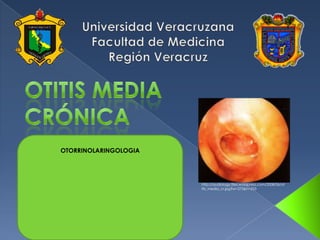 Universidad Veracruzana Facultad de Medicina Región Veracruz Otitis media crÓnica OTORRINOLARINGOLOGIA http://audiology.files.wordpress.com/2008/06/otitis_media_cr.jpg?w=275&h=253 