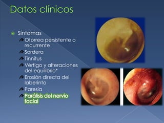 Tratamiento quirúrgico TimpanoplastiaLa cirugía debe llevarse a cabo cuando la infección ha sido tratada adecuadamente y la mucosa del oído medio han sanado, en la cual se repara la membrana del tímpano y de la cadena de huesecillos (en caso de ser requerido).Cirugía timpanomastoideaEn casos refractarios al tratamiento médico, es necesario llevar a cabo cirugía tímpano mastoidea (timpanoplastia combinada con mastoidectomía cortical). Los objetivos de este procedimiento son aerear el oído medio y la mastoides, remover el tejido crónicamente inflamado, reparar el defecto del tímpano y reconstruir la cadena de huesecillos.http://www.teknon.es/consultorio/colome/otorrinolaringologia/01.htmLalwani AK. Diagnóstico y tratamiento en otorrinolaringología, cirugía de cabeza y cuello. México: Manual moderno; 2005Fajardo GD. Otorrinolaringología. México: Intersistemas;2003Paparella MM. Otorrinolaringología, otología y neurootología, volumen II. 3ed. Aregntina: Médica panamericana; 1994 