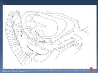 Tratamiento*Medidas no quirúrgicasReducir el grado de actividad inflamatoriaRetirar detritos infectadosIngreso de aguaFármacos ototópicosOfloxacinaNeomicina-polimixina BEsteroides tópicosLalwani A.K. Diagnóstico y tratamiento en Otorrinolaringología, Cirugía de cabeza y cuello. 2ª edición. McGraw-Hill Interamericana. México, 2009. pp. 666 – 672