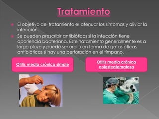    El objetivo del tratamiento es atenuar los síntomas y aliviar la
    infección.
   Se pueden prescribir antibióticos si la infección tiene
    apariencia bacteriana. Este tratamiento generalmente es a
    largo plazo y puede ser oral o en forma de gotas óticas
    antibióticas si hay una perforación en el tímpano.

                                           Otitis media crónica
    Otitis media crónica simple
                                            colesteatomatosa
 