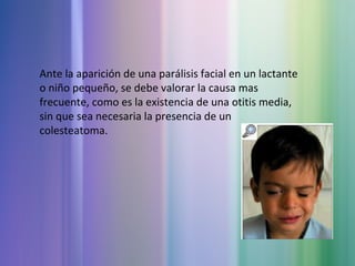Ante la aparición de una parálisis facial en un lactante
o niño pequeño, se debe valorar la causa mas
frecuente, como es la existencia de una otitis media,
sin que sea necesaria la presencia de un
colesteatoma.
 
