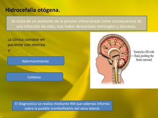 Hidrocefalia otógena.
Se trata de un aumento de la presión intracraneal como consecuencia de
una infección de oído, tras haber descartado meningitis y abscesos.
La clínica consiste en
paciente con otorrea
y:
Adormecimiento
Cefaleas
El diagnostico se realiza mediante RM que además informa
sobre la posible tromboflebitis del seno lateral.
 