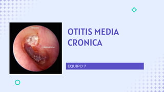 OTITIS MEDIA
CRONICA
EQUIPO 7
 
