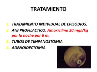 TRATAMIENTO

1. TRATAMIENTO INDIVIDUAL DE EPISODIOS.
2. ATB PROFILACTICO: Amoxicilina 20 mgs/kg
   por la noche por 6 m.
3. TUBOS DE TIMPANOSTOMIA
4. ADENOIDECTOMIA
 